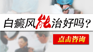 武汉白癫疯医院?白癜风不治疗能自己好吗